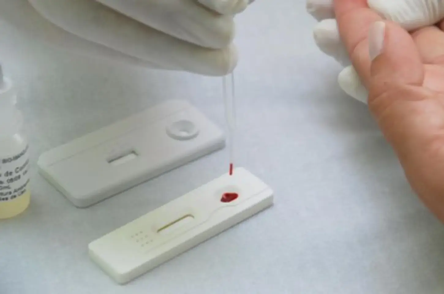 Campanha Outubro Verde: Tupã oferece testes rápidos de sífilis sem agendamento neste sábado