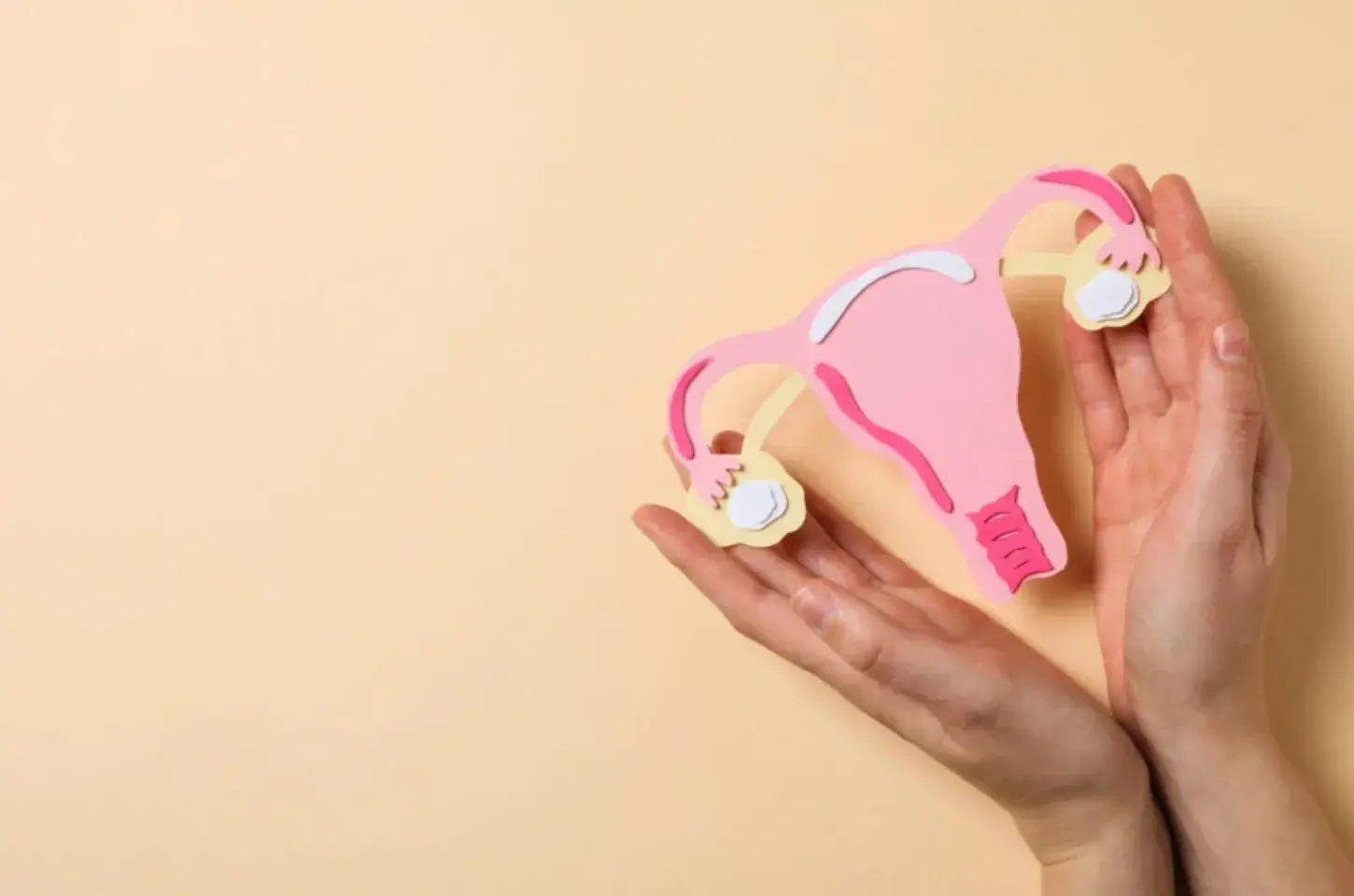 Endometriose causa infertilidade se descoberta tardiamente